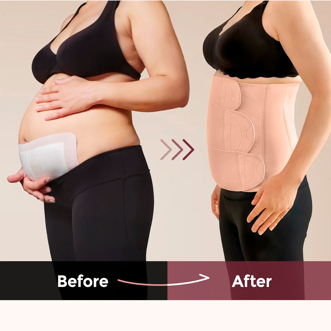 Faja Post Parto Ergo Wrap Momcozy